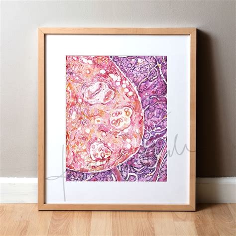 Breast Cancer Art - Etsy