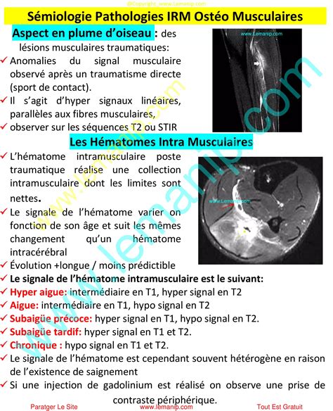 Sémiologie Pathologie En IRM