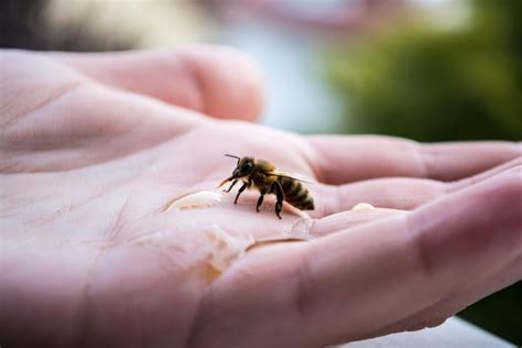 Was Tun Bei Einem Bienenstich So Behandelt Man Ihn