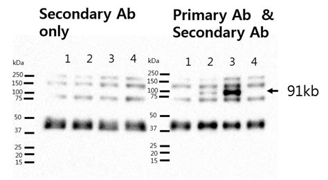 Are There Any Methods To Block Non Specific Secondary Antibody Binding