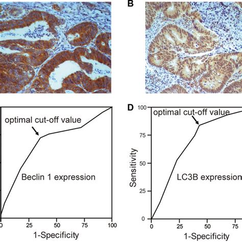 The Expression Of Beclin 1 And LC3B In CRC Examples Of Beclin 1 A