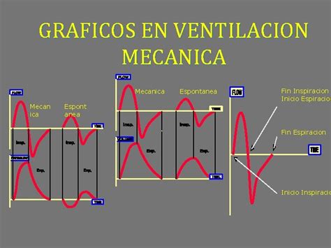 GRAFICOS EN VENTILACION MECANICA Mecanica Mecan Ica Espont