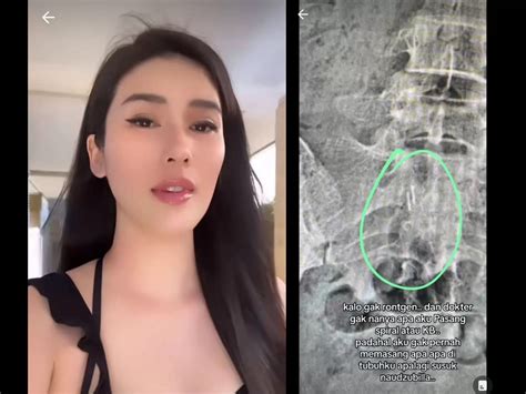 Kematian Artis Stevie Agnecya Masih Menyisakan Misteri Diduga