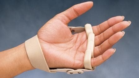 3pp Polycentric Hinged Left Hand Ulnar Deviation Splint For RA