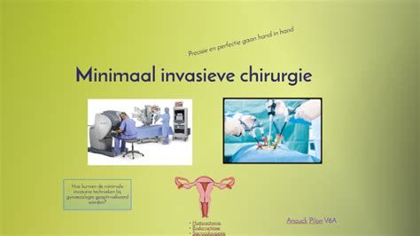 Minimaal Invasieve Chirurgie By Anouck On Prezi