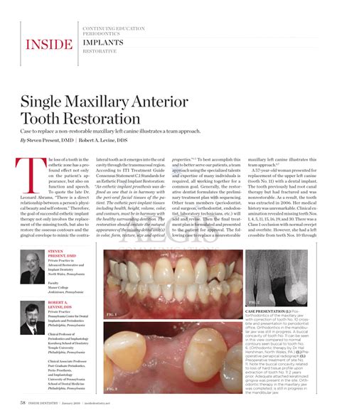 (PDF) Single Maxillary Anterior Tooth Restoration