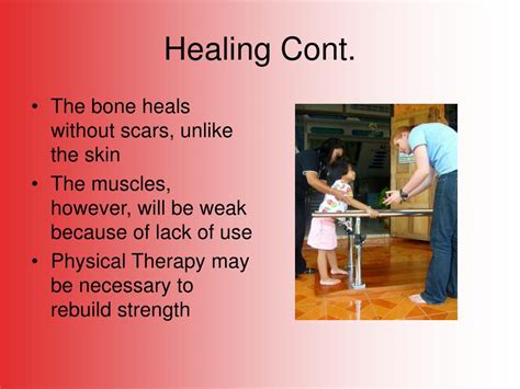 Ppt Broken Bones Powerpoint Presentation Free Download Id4121003