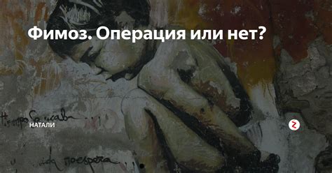 Фимоз. Операция или нет? | Натали 50+ | Дзен