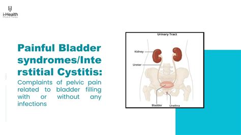 Ppt 5 Classification Of Urinary Incontinence Powerpoint Presentation