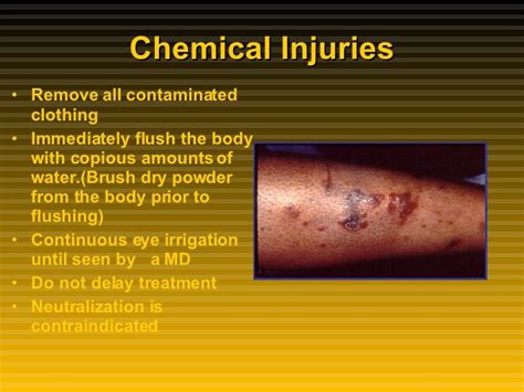 Burns Thermalelectricallightening And Chemical Injuries