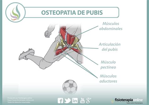 Cirugía De Osteopatía De Pubis Cómo Se Realiza La Operación Y Cómo Es