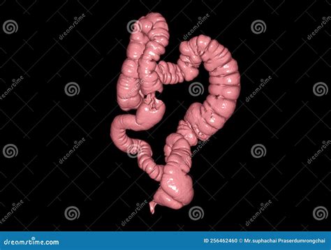 Ct Colonography 3d Rendering Stock Illustration Illustration Of Body