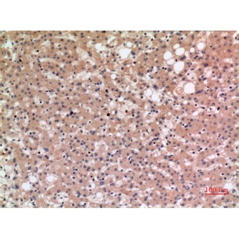 Anti SLC10A1 NTCP Antibody Rabbit Anti Human Polyclonal LSBio