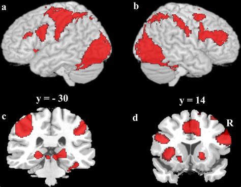 Dissociable Prototype Learning Systems Evidence From Brain Imaging And