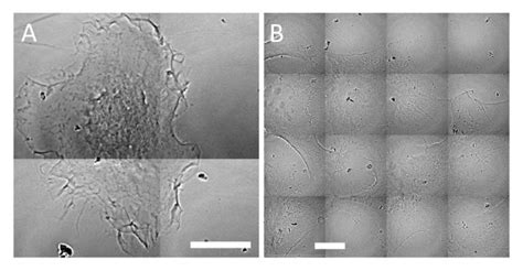 Transmission X Ray Microscopy Image Of Emt And Hela Cells Without