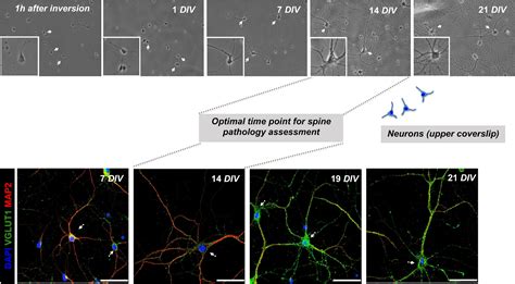 Frontiers Reactive Astrocytes Contribute To Alzheimers Disease