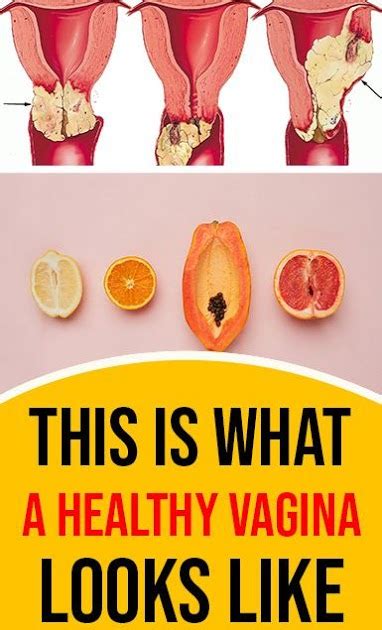 This Is What A Healthy Vagina Looks Like