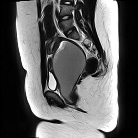 Viewing Playlist Abdomen Radiopaedia Org