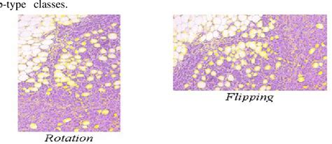 Figure 5 From Automated Classification Of Breast Cancer Histology