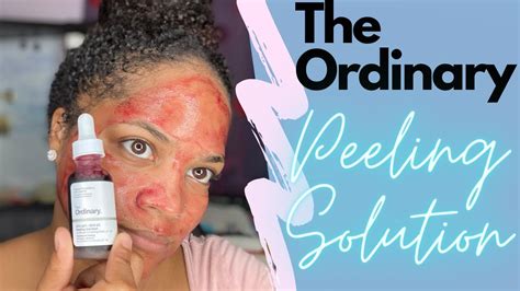 The Ordinary Peeling Solution Aha 30 Bha 2 1st Impressions Youtube