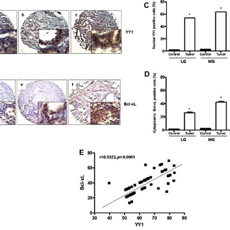 Inhibition Of Bcl Xl Expression By Detanonoate And The Role Of Bcl Xl