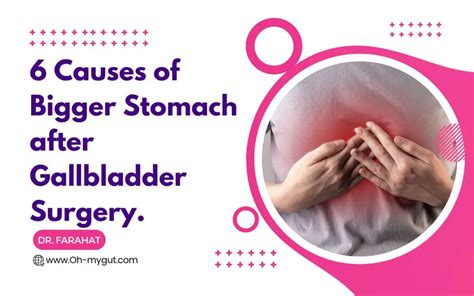 6 Problems After Gallbladder Removal Years Later Dr Farahat Oh My Gut