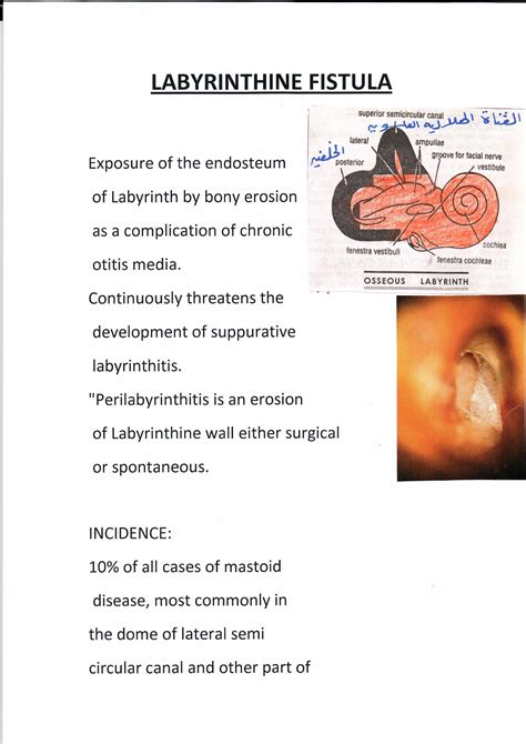 المدونة الطبية دفهيد سالم السبيعي Labyrinthine Fistula