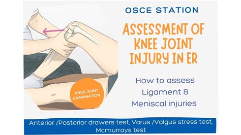 Examination Of Knee Joint Assessment Of A Knee Joint Injury OSCE