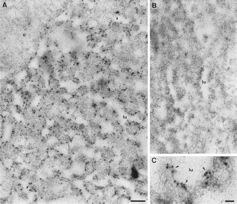 Immunogold Labeling Of Ultrathin Section Of BHK 21 Cells Electroporated