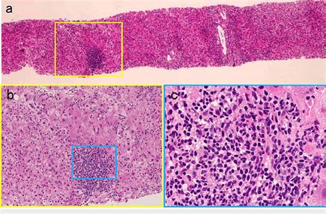 Histopathological Findings Of The Liver Biopsy Hematoxylineosin Download Scientific Diagram