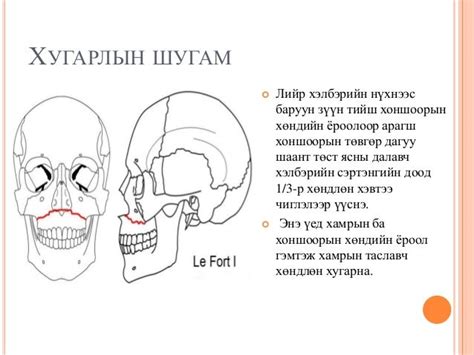 лефорд I