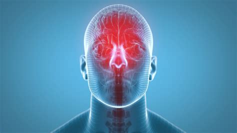 Increased Intracranial Pressure NYSORA