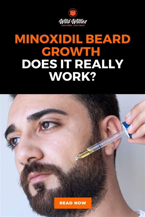 The 6 Most Common Issues Faced When Growing A Beard Artofit