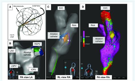 Study Catheter And Electroanatomic Visualization A Expandable