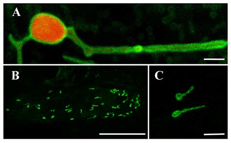 Ijms Free Full Text Functional Analysis Of Rice Long Chain Acyl Coa