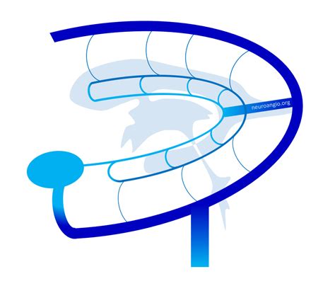 Internal Cerebral Vein | neuroangio.org