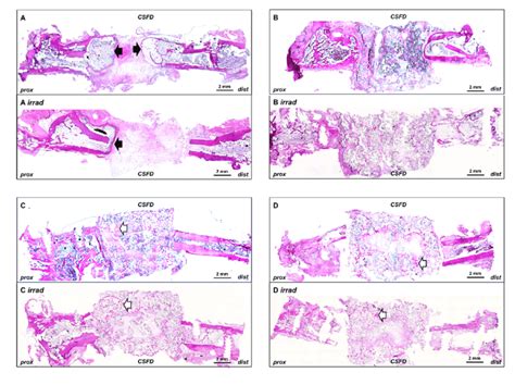 Bone Formation In Implanted Constructs The Newly Formed Bone Tissue