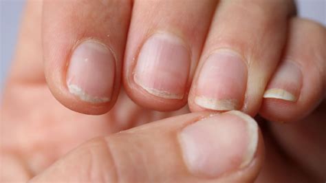 How To Keep Your Nails Clean Tips For Fingernails And Toenails