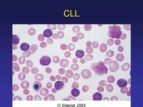 Ppt Leukopenia Leukocytosis Powerpoint Presentation Free Download Id 425635