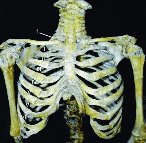 Skeleton Of The Thorax In The Fetus Of 290 0 Mm Of CRL Front View