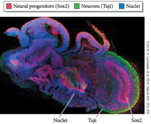 Documentaries on Organoid Development - Barresi Lab