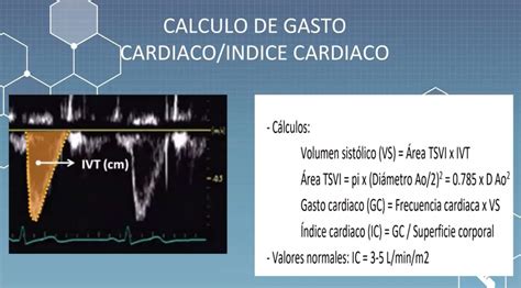 Distrito Adem S Paralelo Calculo Gasto Cardiaco Ecocardiograma Ruidoso