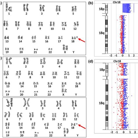 Cytogenetic And Molecular Findings In Cultured Skin Fibroblasts Of