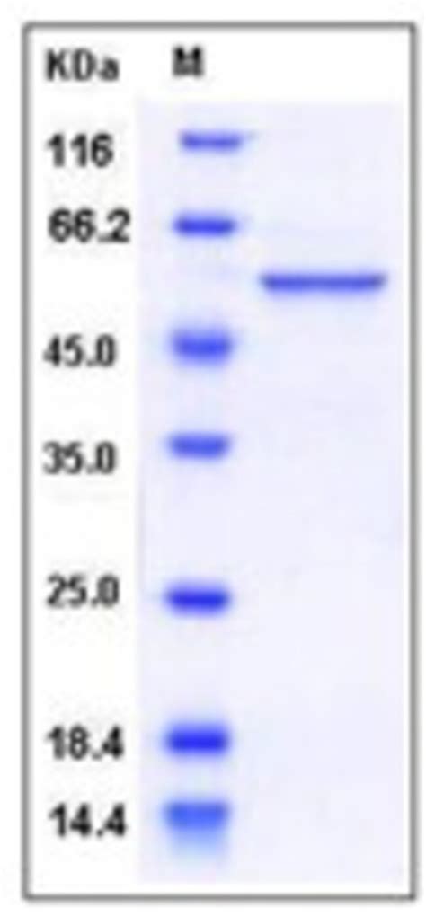 Sino Biological Human RBBP4 RBAP48 Protein His Tag 500ug Quantity