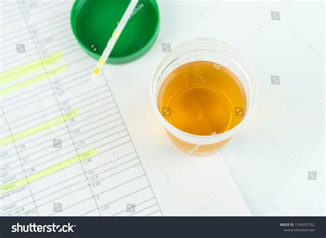 Check Routine Urinalysis Reagent Strip Urinalysis Stock Photo