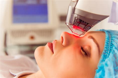 Laser Treatments For Rosacea Frequently Asked Questions