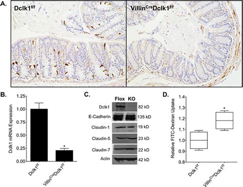 Characterization Of Intestinal Epithelial Deletion Of Dclk1 Under