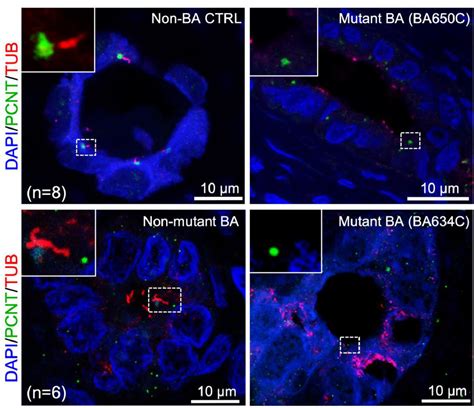 Identification Of A Wide Spectrum Of Ciliary Gene Mutations In