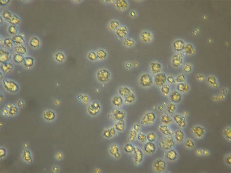 Hybridoma Cells Not Forming Colonies Can Anyone Help Researchgate