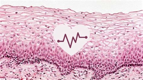 Epithelial Cell Abnormality: Causes Symptoms and Treatment